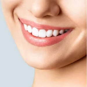 Exclusive Dental Packages